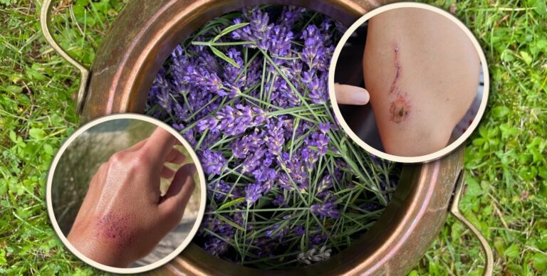 Hydrosols can help your skin heal faster